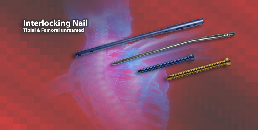 Interlocking Nail surgical implants and instruments by digimed Medizintechnik