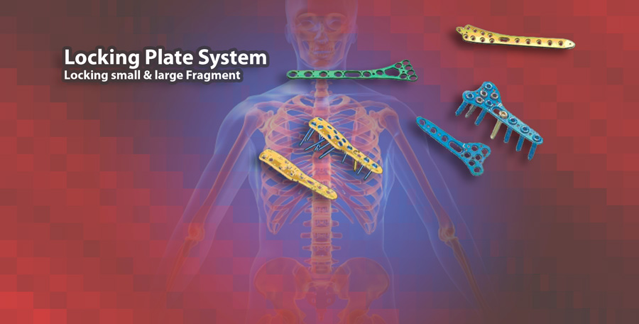 Locking Plate System Locking plates small and large Frgament implants by digimed Medizintechnik