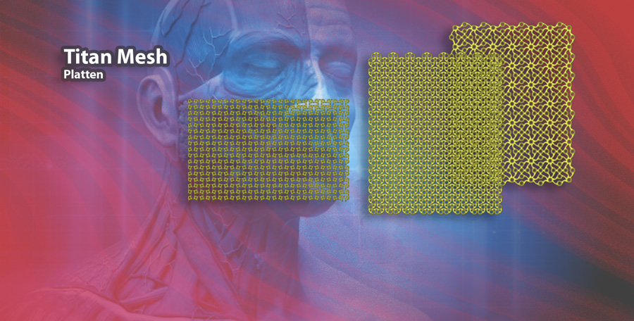 Titan Mesh Verriegelungsplatten klein und groß Frgament Implantate von digimed Medizintechnik